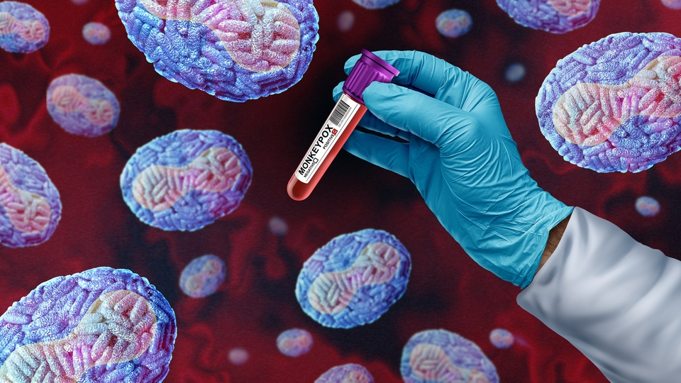 Almanya'da M çiçeğinin yeni varyantı Klad 1 ilk kez tespit edildi