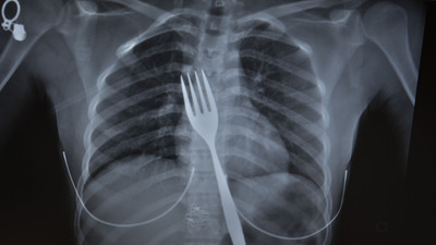 Yuttuğu çatal bilimsel makaleye konu olacak