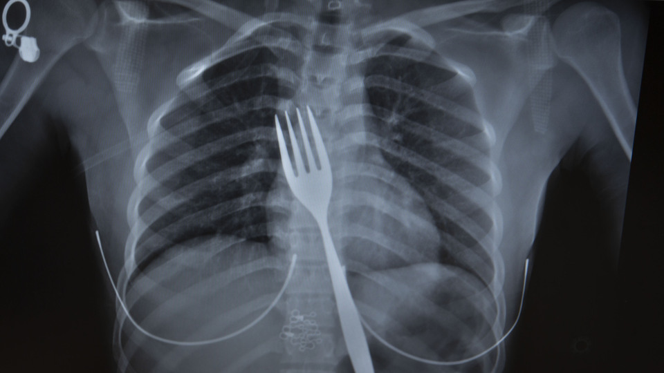 Yuttuğu çatal bilimsel makaleye konu olacak