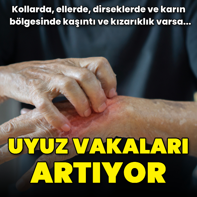 "Uyuz vakalarının sayısı her geçen gün artıyor"