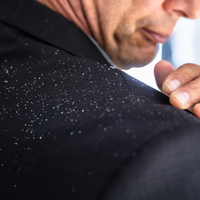 Kepekli saçlardan kurtulmanın yolları nelerdir?