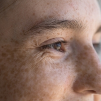 Yüz ölü deriden nasıl arınır?