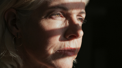 Güneşe çıkamama hastalığı nedir?