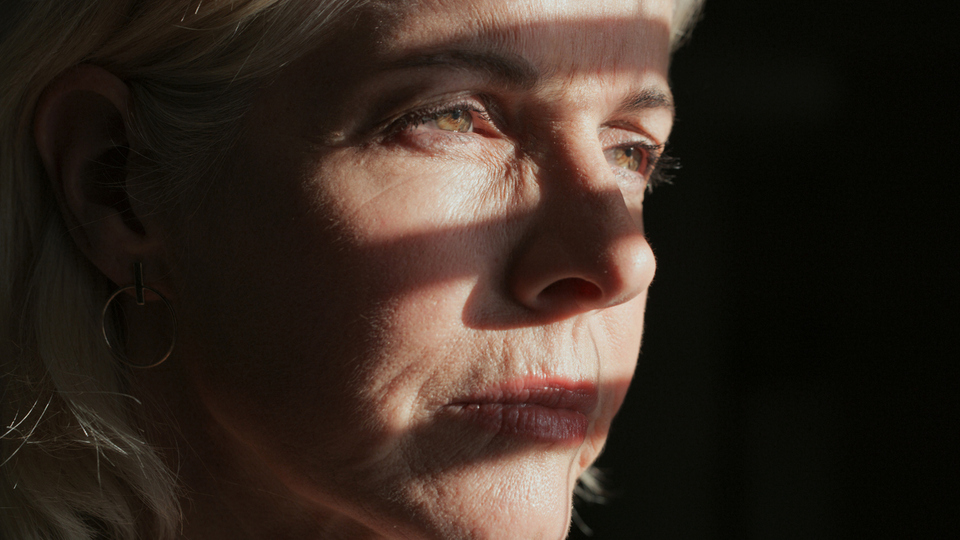 Güneşe çıkamama hastalığı nedir?