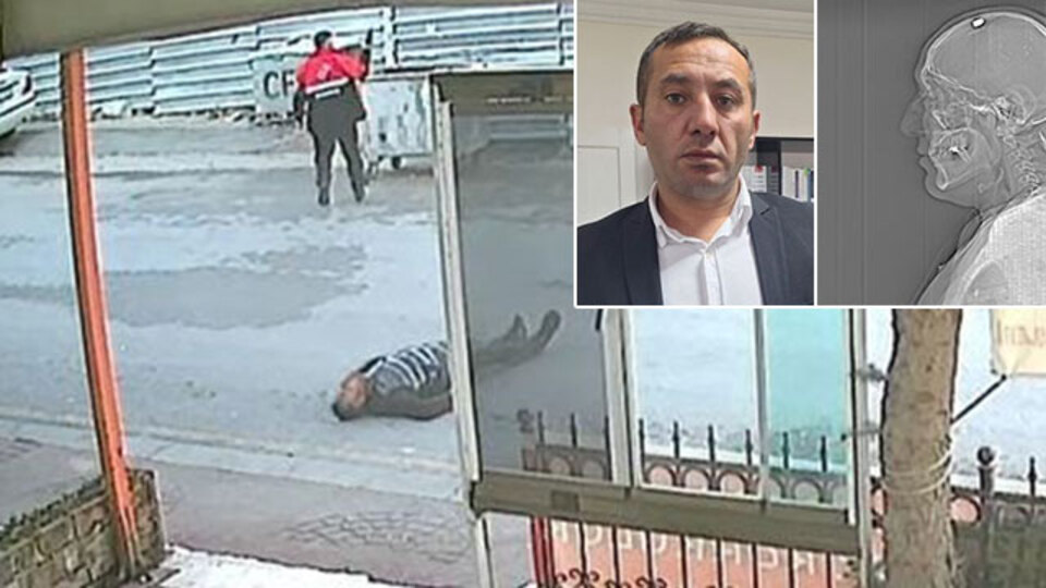 Silahla başından vuruldu! Ölü taklidi yaparak kurtuldu!