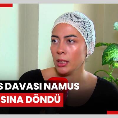 Miras tartışmasında amcası demir çubukla dövdü: Ölen kadınlardan birisi olmak istemiyorum