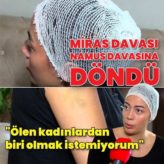 Miras davası namus davasına döndü: "Ölen kadınlardan biri olmak istemiyorum"