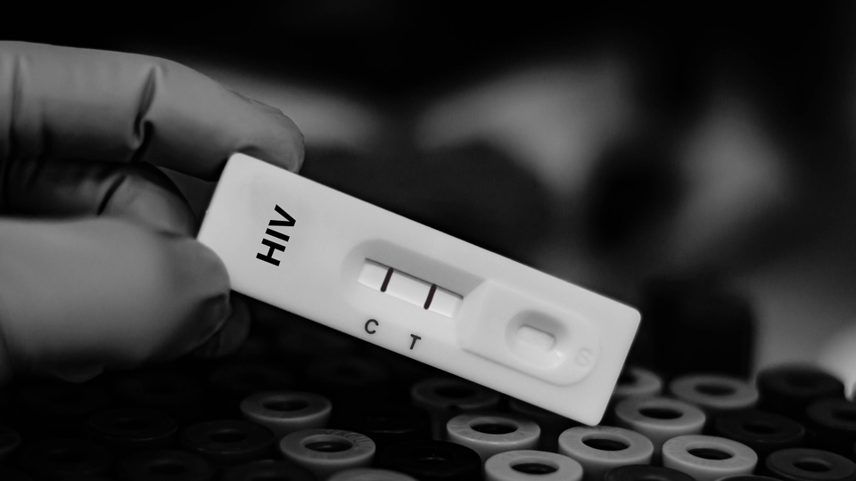 Türkiye'de çocuklarda HIV vakaları artıyor