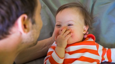 Down Sendromu hakkında bilinmesi gerekenler
