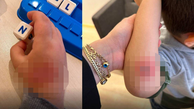 Bakanl�k harekete ge�ti! 2 �ocu�a k�t� muamele! 1 ki�i g�zalt�nda