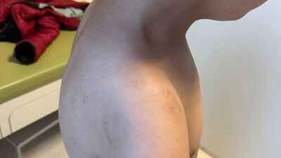 Otizmli çocuğa şiddet iddiası!