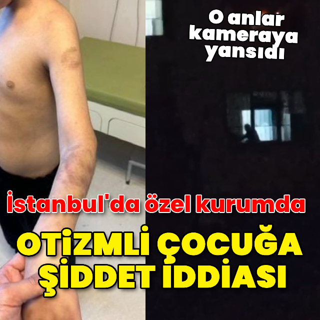 Otizmli çocuğa şiddet iddiası!