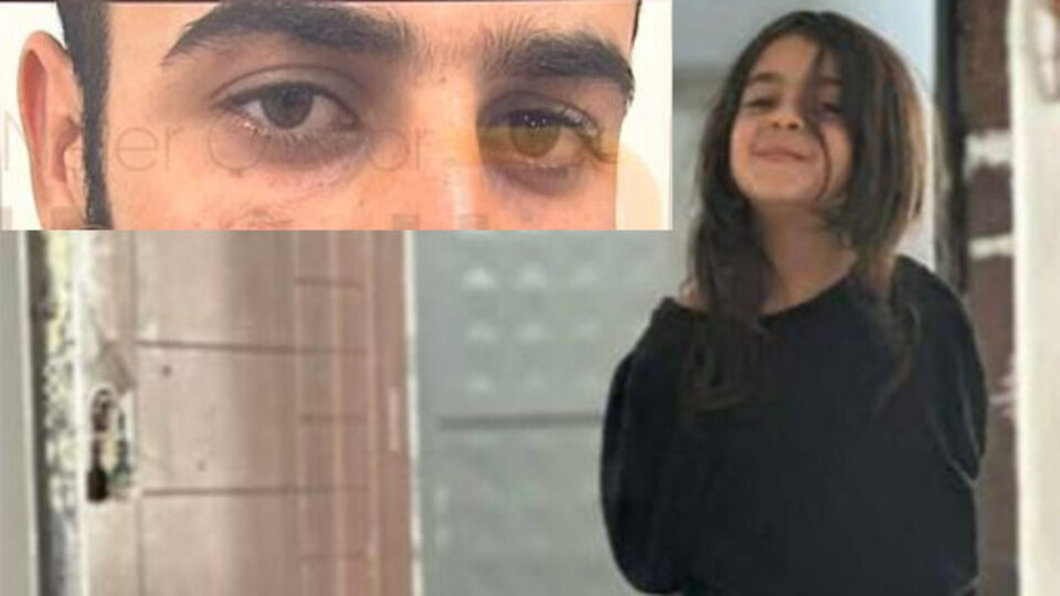 Enes Güran'ın gözünün altındaki diş izi!