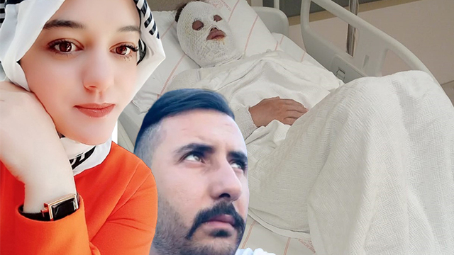 Eski nişanlısının yüzüne kimyasal madde atmıştı: Akıl sağlığı yerinde çıktı