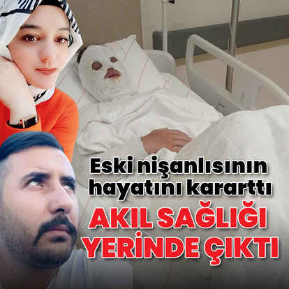 Eski nişanlısının yüzüne kimyasal madde atmıştı: Akıl sağlığı yerinde çıktı