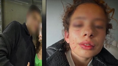 Sevgilisine işkence yaptı!