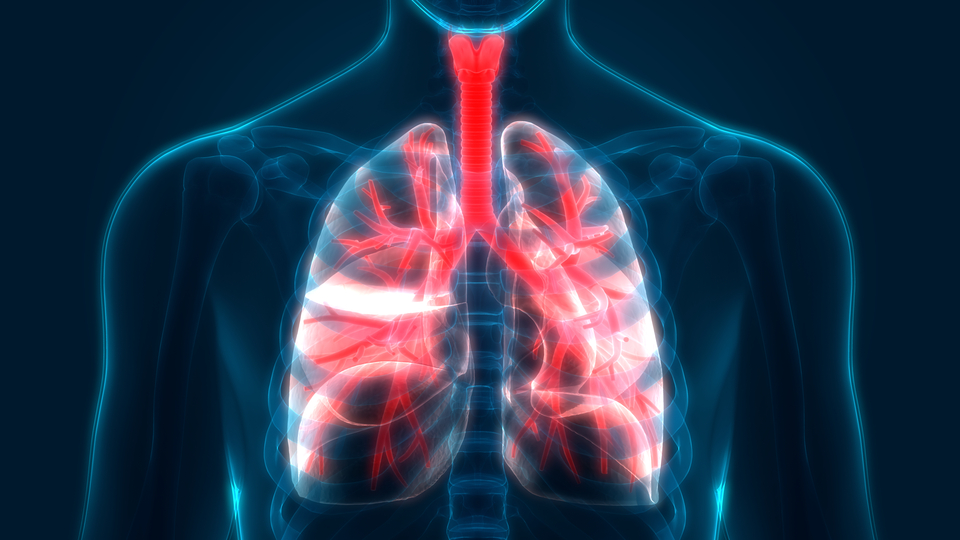 Akciğer kanseri önlenebiliyor