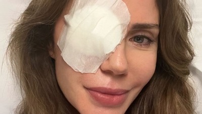 Arpacığını aldırdı