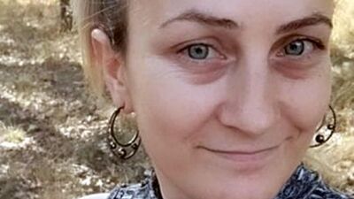 Eski eşinin bıçakladığı Songül'den acı haber!