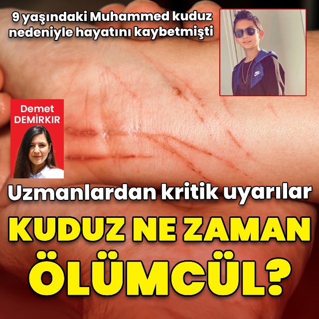 Kuduz ne zaman ölümcül?
