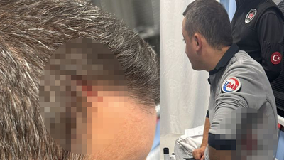 Sigara kavgası! 2 güvenlik görevlisi bıçaklandı