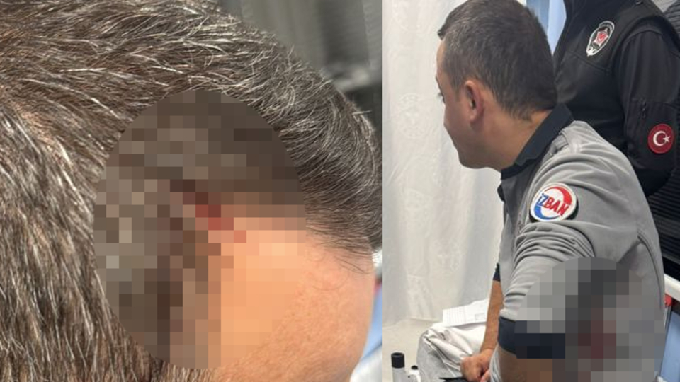 Sigara kavgası! 2 güvenlik görevlisi bıçaklandı