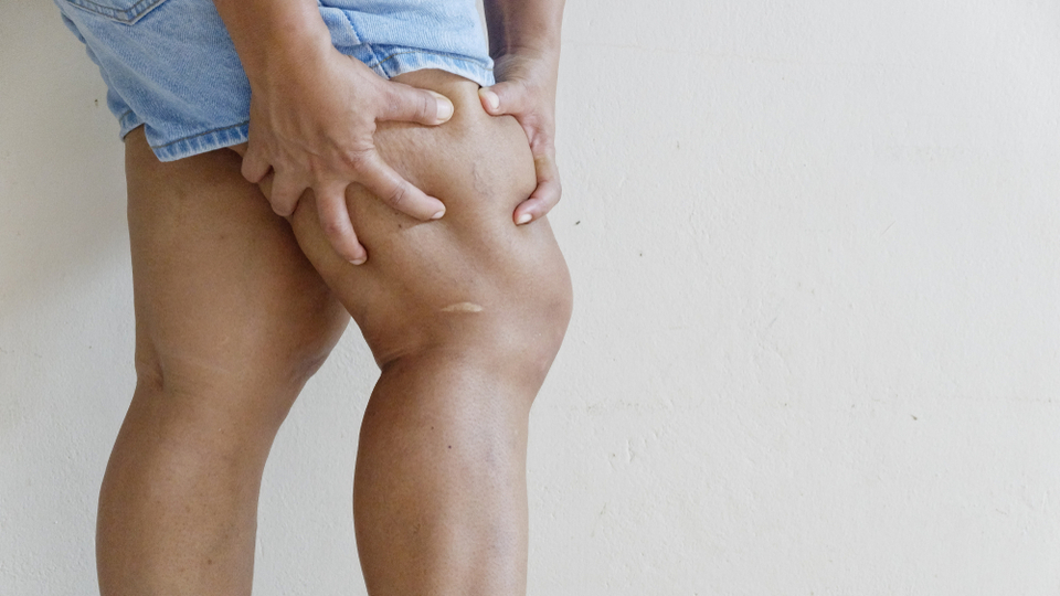 Selülit için evde yapılabilecek öneriler