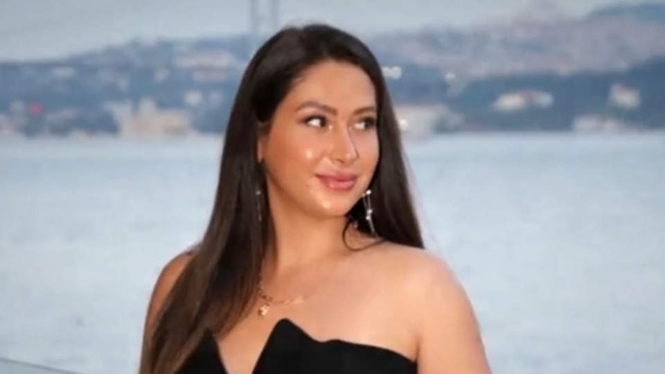 Ünlü fenomeni öldüren estetik!