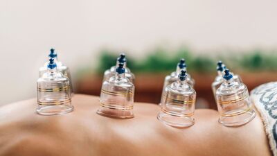 Hacamat nedir, nasıl yapılır?