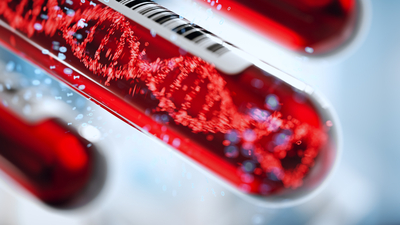 Kanser genetik mi? Genetik test nasıl yapılır?