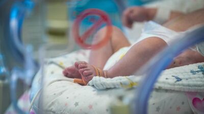 Dünyada sayılı! 1000 gramlık kalp hastası...