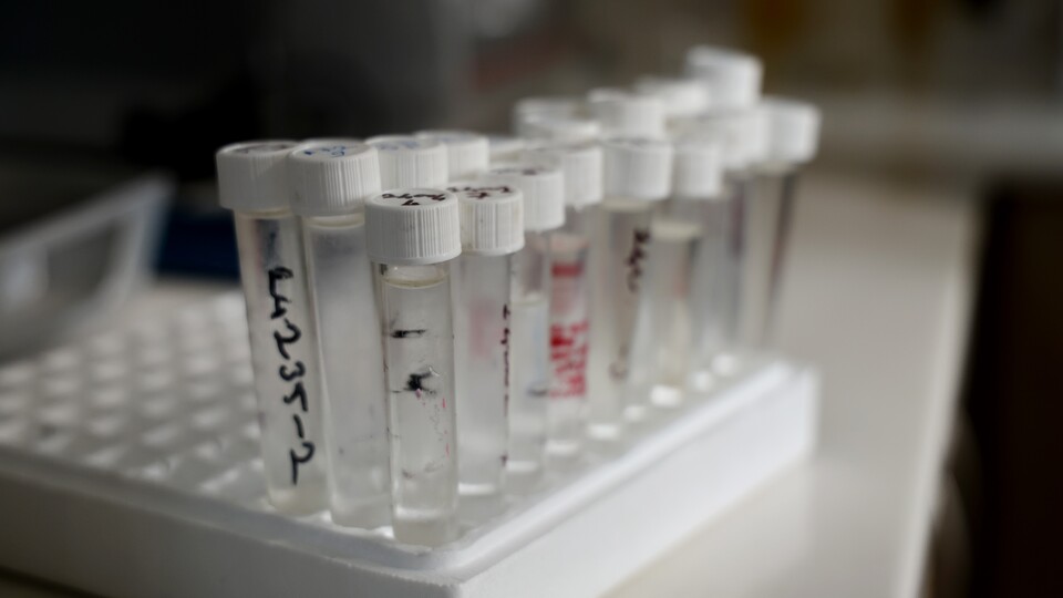 İstanbul'da sahte içkiden 30 can kaybı!