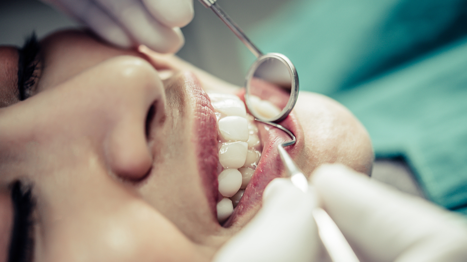 Diş dolgusundan sonra yemek yenir mi?