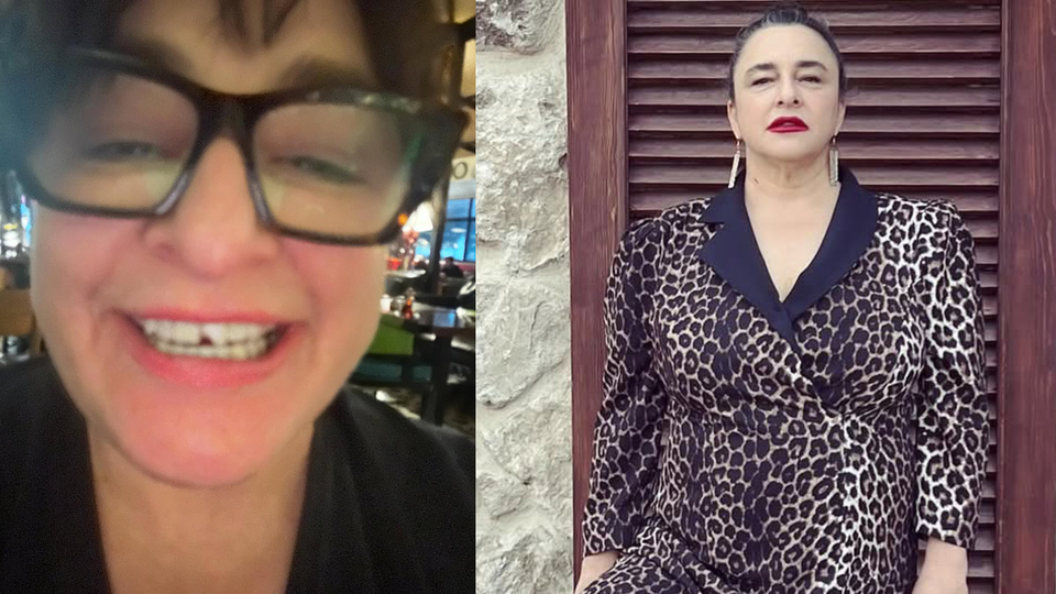 "Çocuk gibi dişimi kırdım"