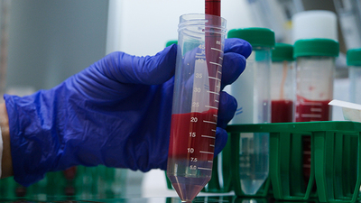 Hitit ve Maryland üniversitelerinden KKKA aşısı üzerinde ortak çalışma