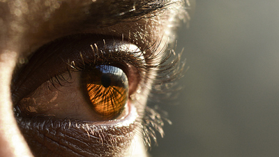 Bahçesindeki kediden bulaştı, görme kaybına yol açtı