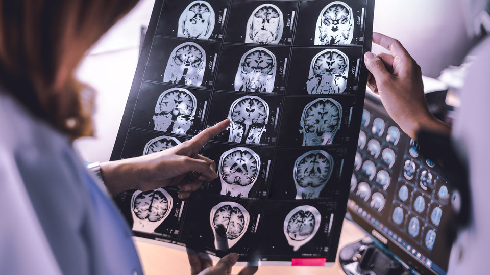 Uykunun REM evresine geçişte zorlanmak Alzheimer belirtisi olabilir