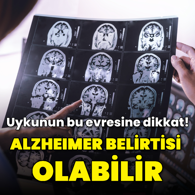Uykunun REM evresine geçişte zorlanmak Alzheimer belirtisi olabilir