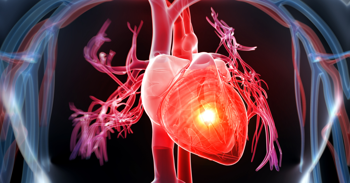 Kalp Krizi İstatistikleri