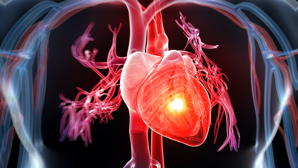 Kalp krizi sonrası ölümlerde AB birincisiyiz