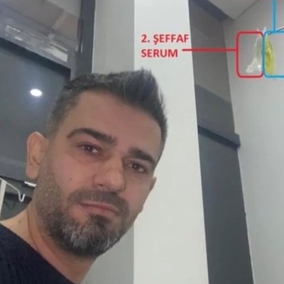  Sarı serum öldürdü!