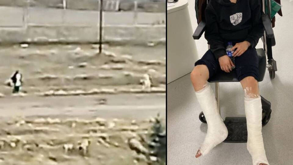 İki ilde köpekler iki çocuğa saldırdı