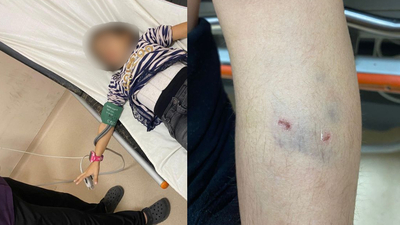 Okul bahçesinde köpek saldırdı