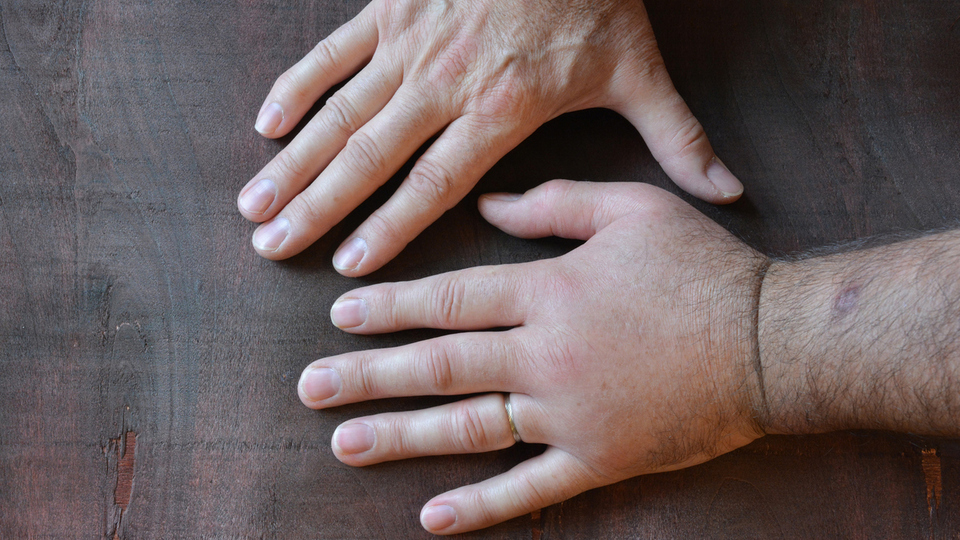 İşte hızlıca ödem attıran yöntemler