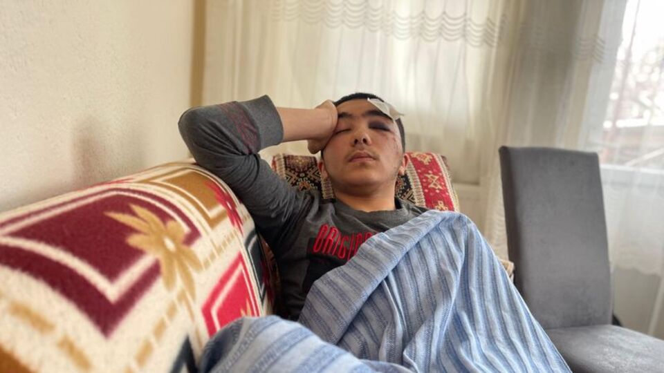 Köpek saldırısında kafatası çatladı