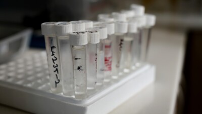 Ankara'da sahte içkiden can kaybı 38'e yükseldi!