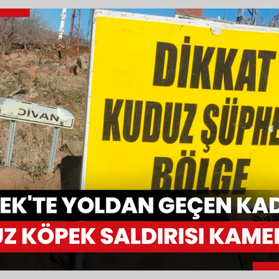 Siverek'te kuduz alarmı: Yoldan geçen kadına kuduz köpek saldırısı kamerada