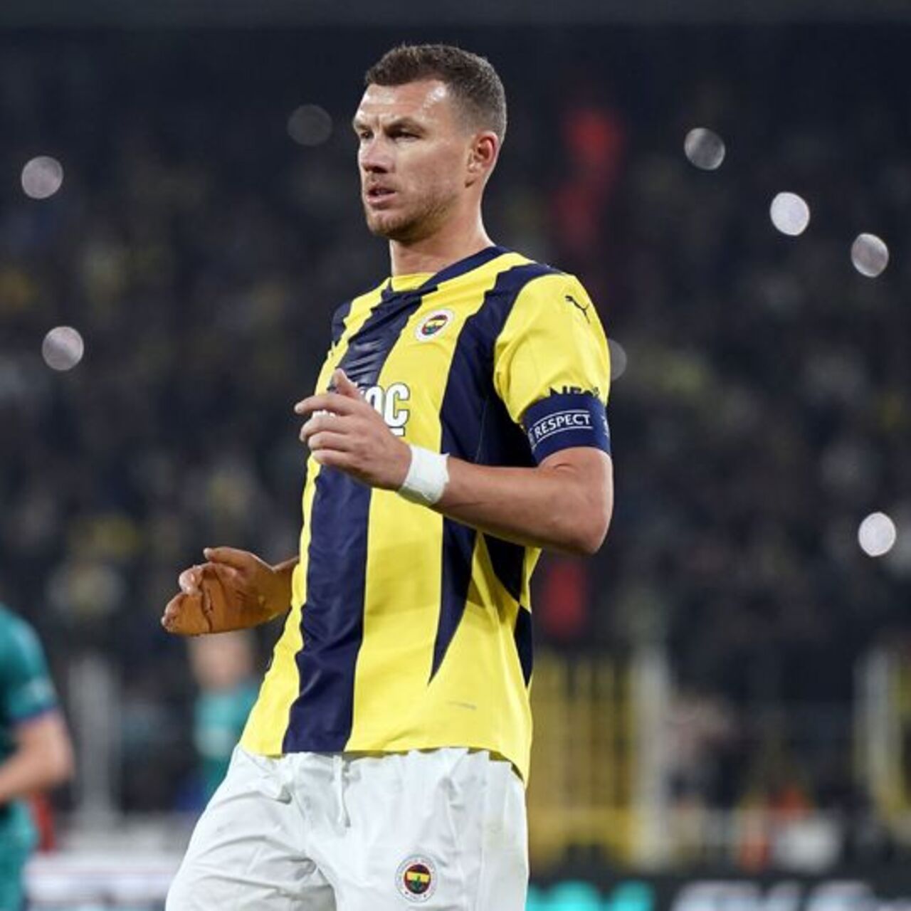 Edin Dzeko'nun elinde kırık tespit edildi!
