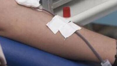 Kan akması orucu bozar mı?