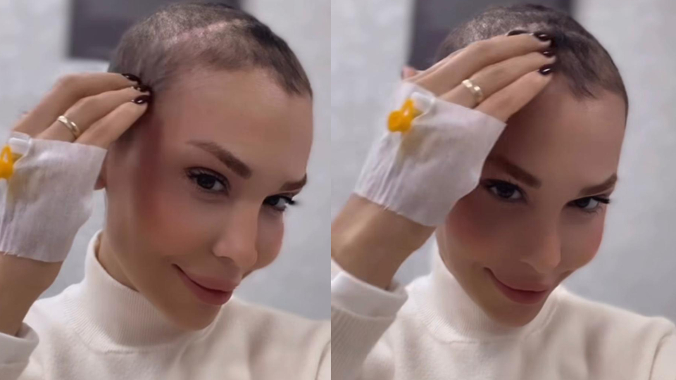 "Saçlarım yerine gelmeye başladı"